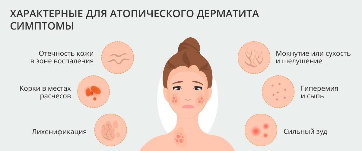 Лечение дерматита на лице народными средствами: пероральный, атопический, аллергический, контактный