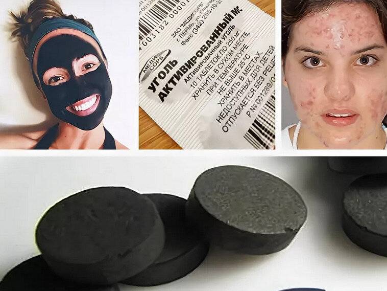Домашние маски от прыщей и черных точек: советы и рецепты