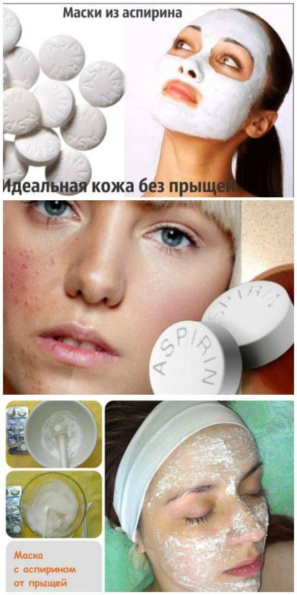 Ацетиловая кислота от прыщей, применение аспирина в косметологии, 12 масок для лица в домашних условиях