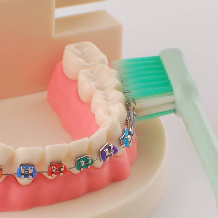 Электрические зубные щетки oral-b: рейтинг лучших моделей
