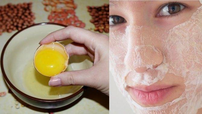 Доступно, натурально, полезно: маски для кожи лица из яичного белка