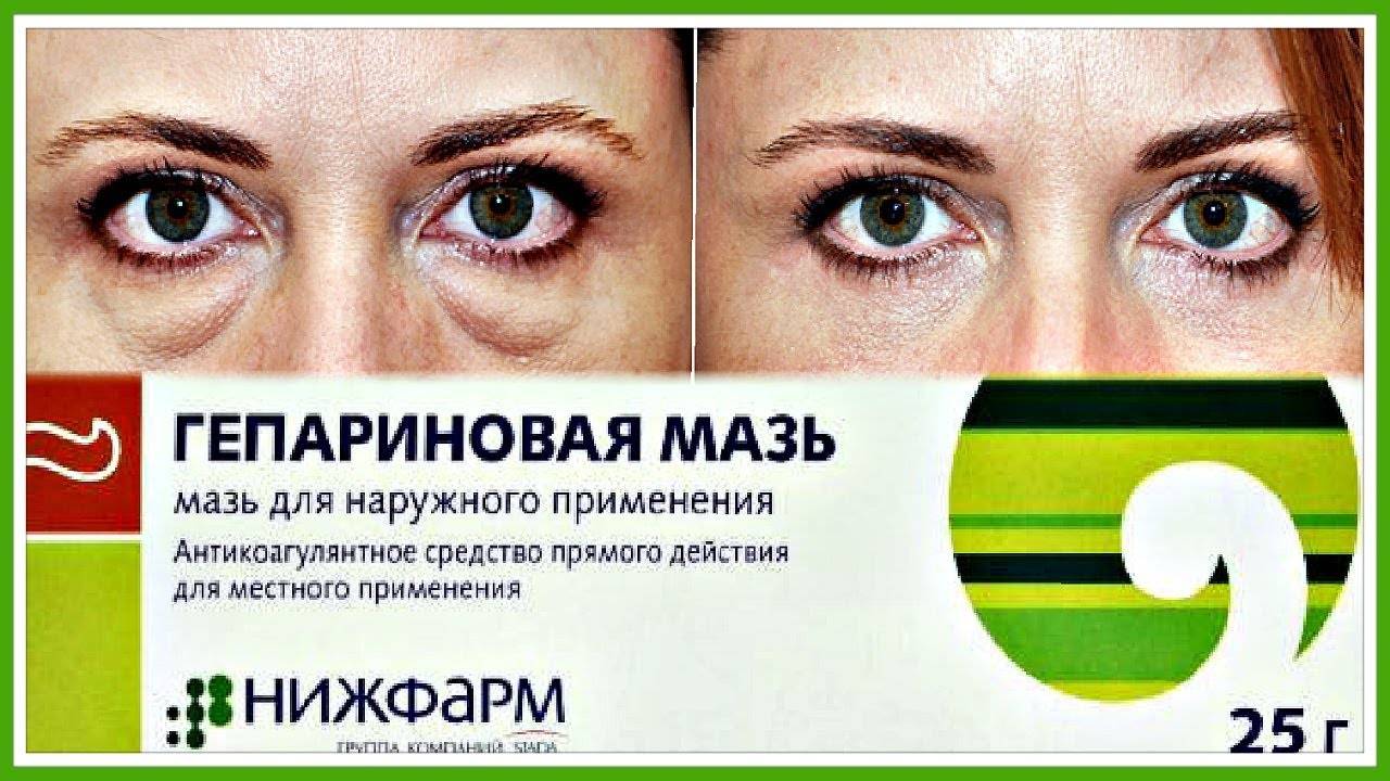 Гепариновая мазь от морщин под глазами: отзывы, особенности применения и эффективность :: syl.ru