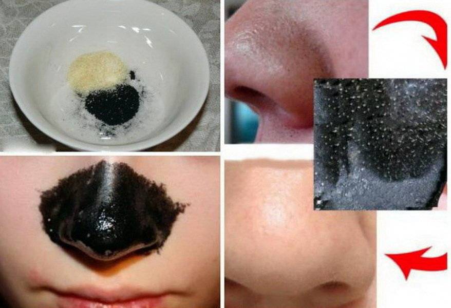 Угольная маска для лица: очищающая маска с активированным углем, рецепты черных масок из таблеток | marykay-4u.ru