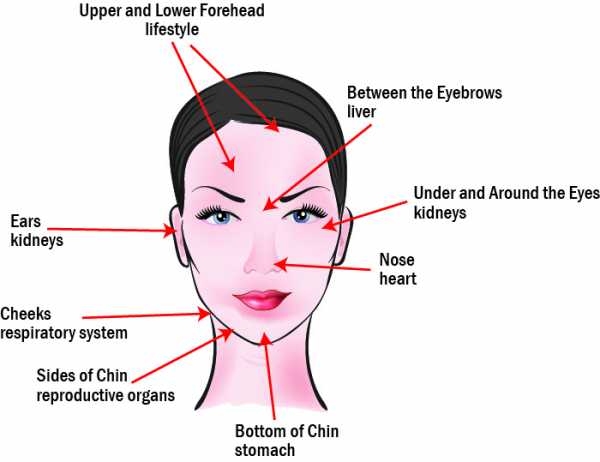 Прыщи, воспаления на лице причины по зонам - подробная информация