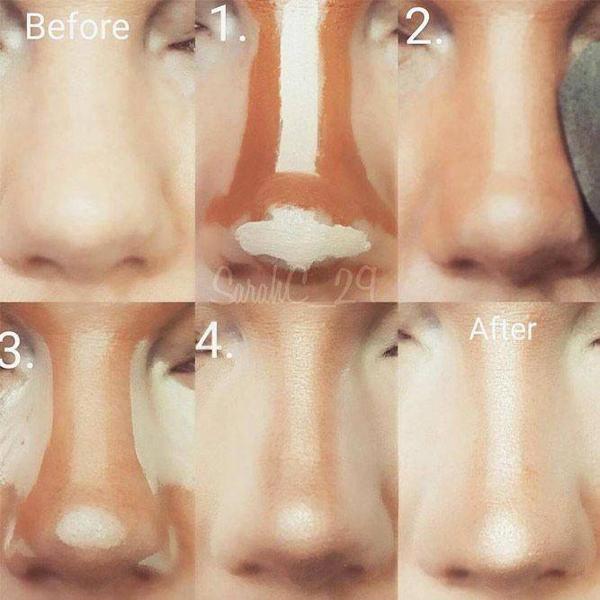 Оптимальные способы уменьшения носа, применение клипс | glory skin