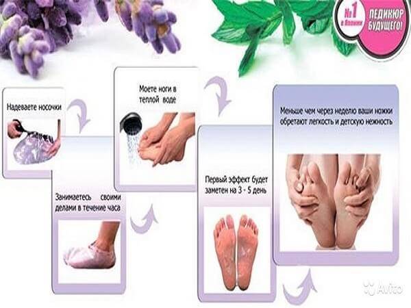 Носочки для педикюра – пошаговая инструкция по применению носочков для ухода за стопами ног + обзор самых популярных марок продукта