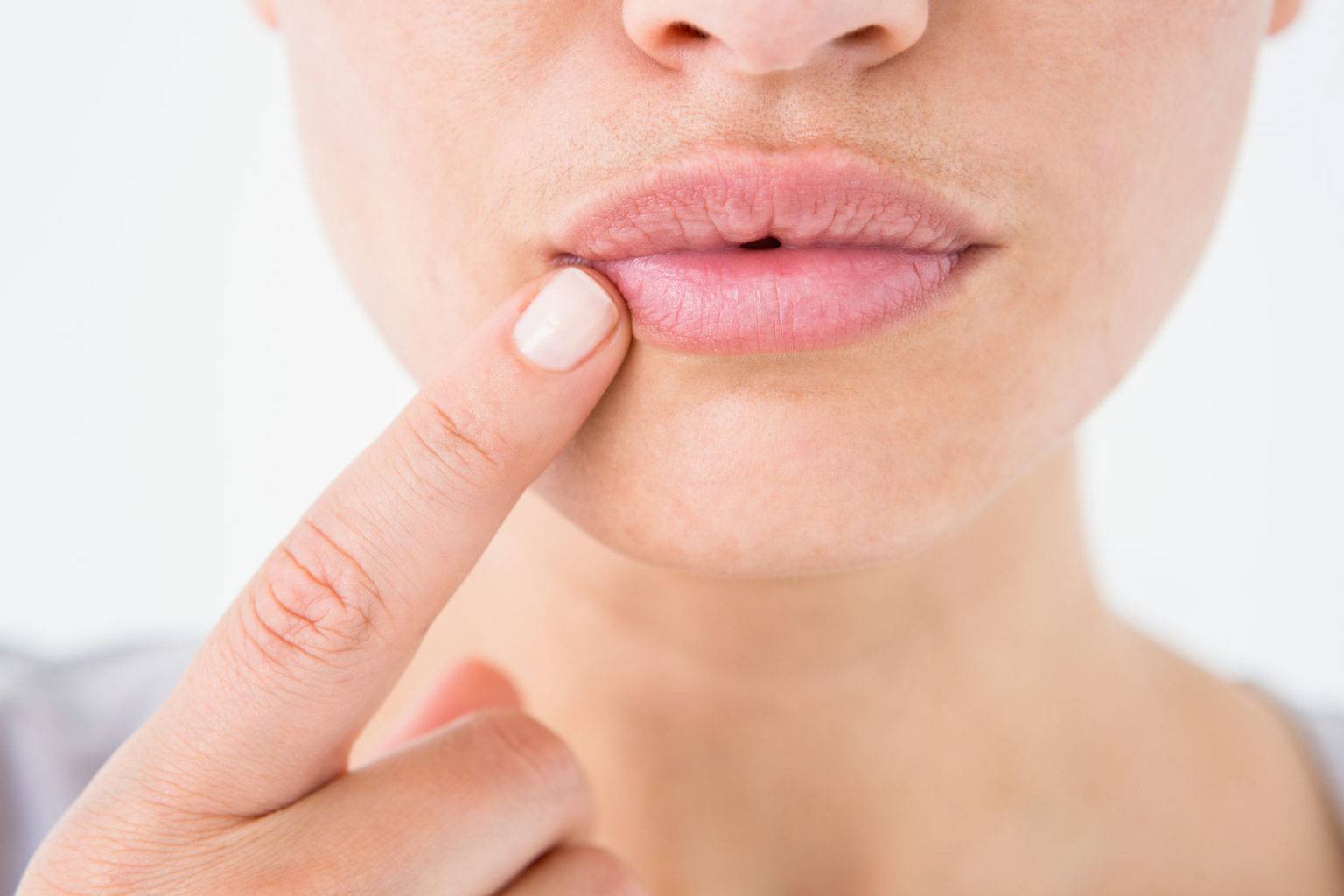 Трещины в уголках губ | eurolab | стоматология