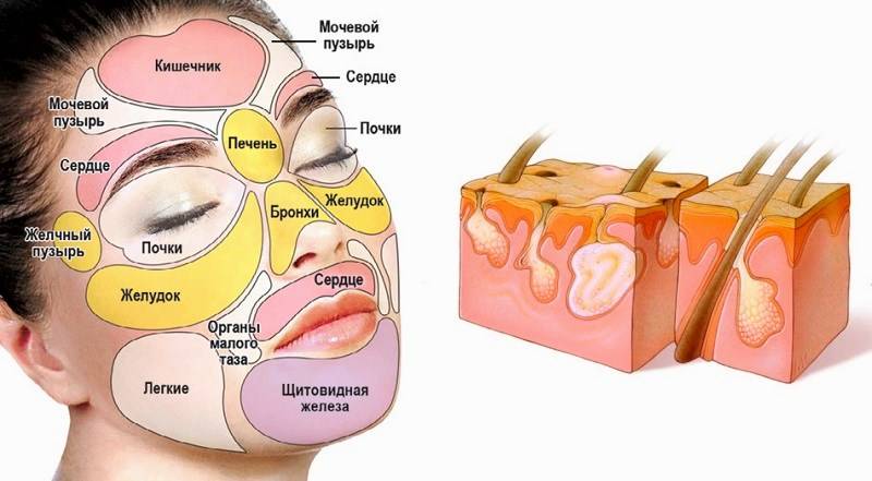 Невроз лица: симптомы и признаки, почему происходит онемение лицевых мышц, что такое парестезия лица, лечение