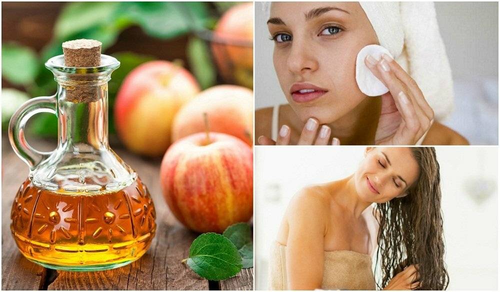 Применение яблочного уксуса для лица: действенное средство против несовершенств кожи