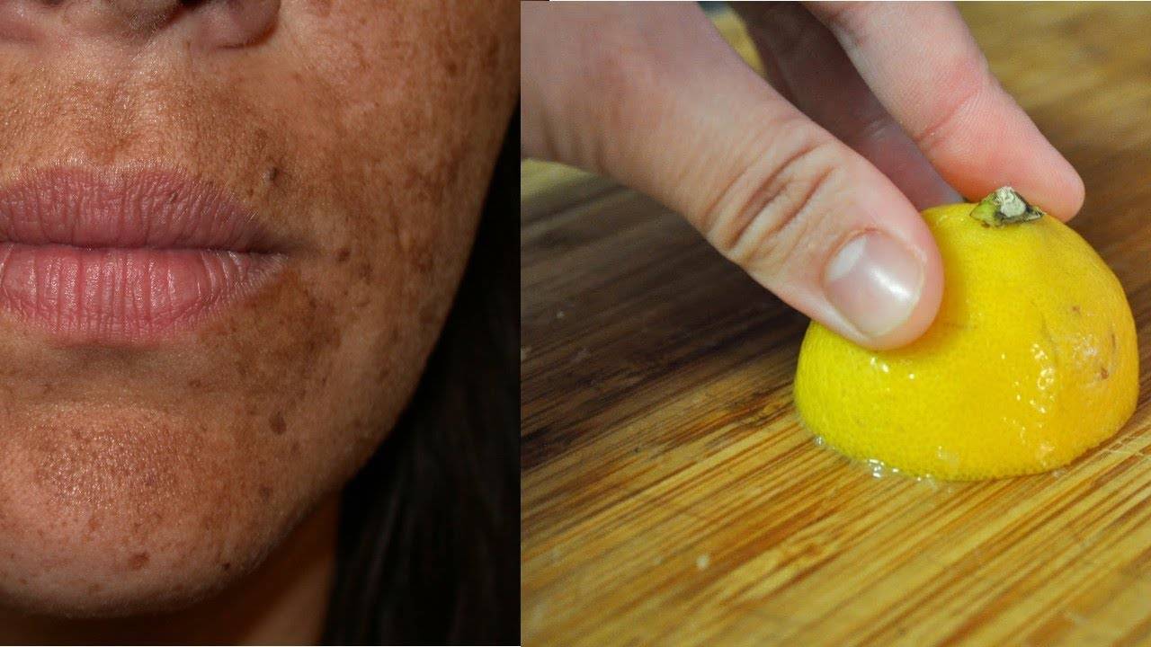 Эфирное масло лимона для лица: омолодит и очистит поры