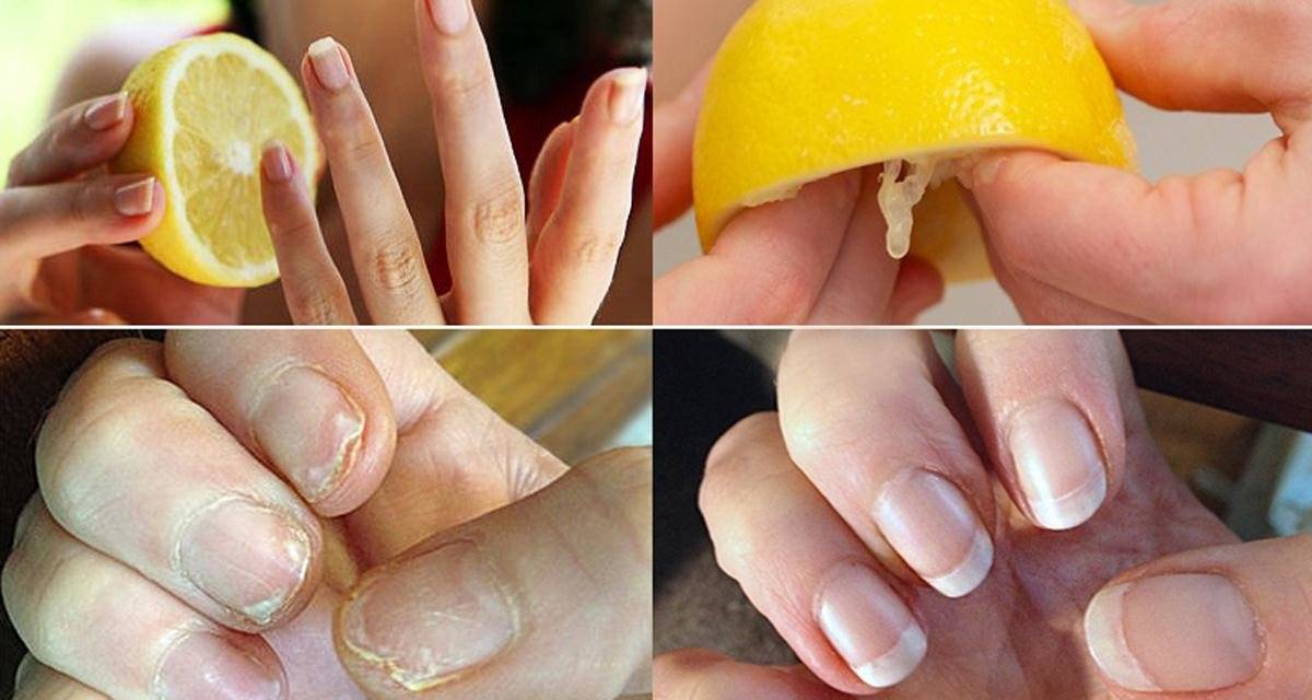 Как быстро отрастить ногти: 12 способов в домашних условиях