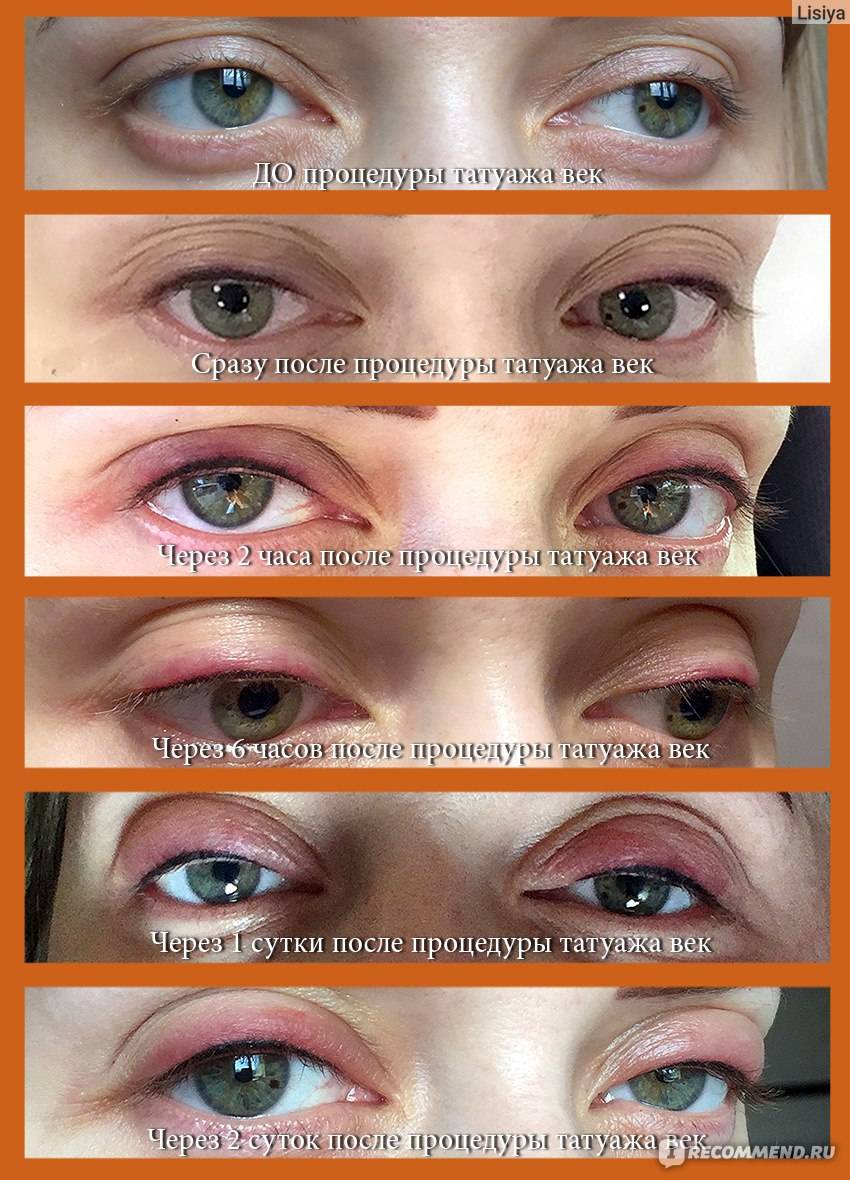 Вреден ли татуаж глаз для зрения?
